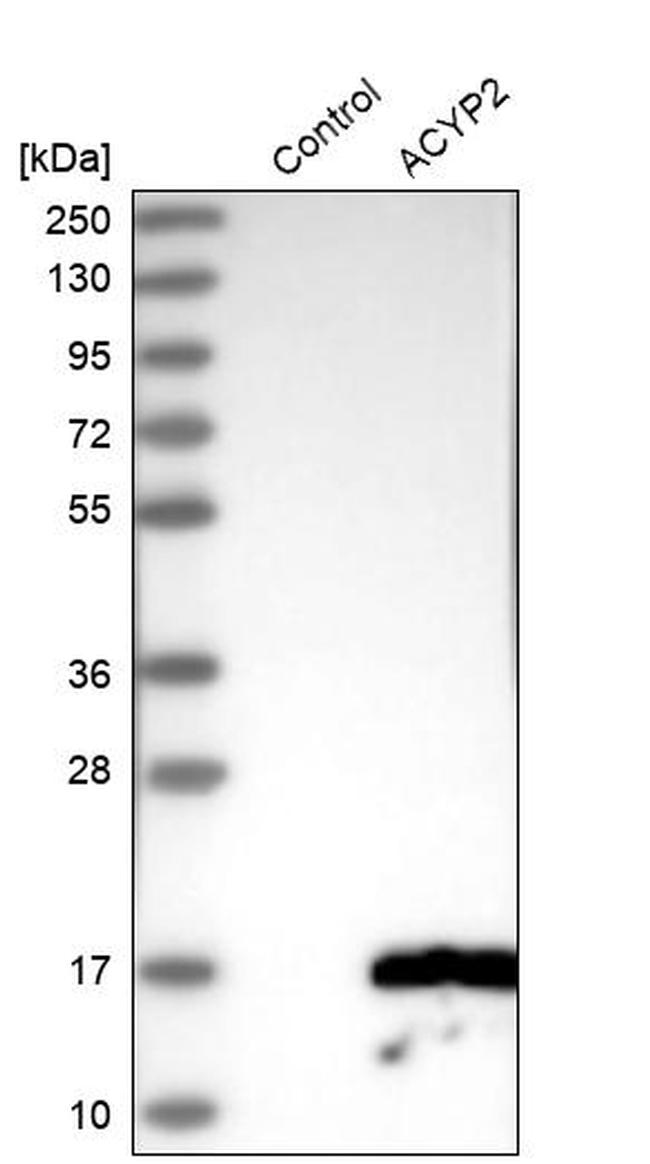 ACYP2 Antibody in Western Blot (WB)