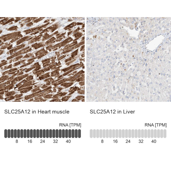 SLC25A12 Antibody