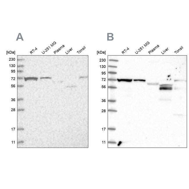 SLC25A12 Antibody in Western Blot (WB)