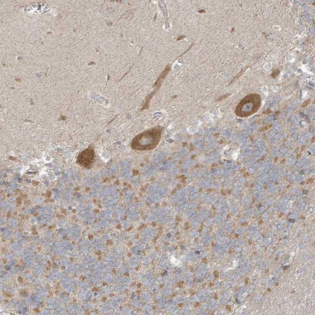 CNP Antibody in Immunohistochemistry (IHC)