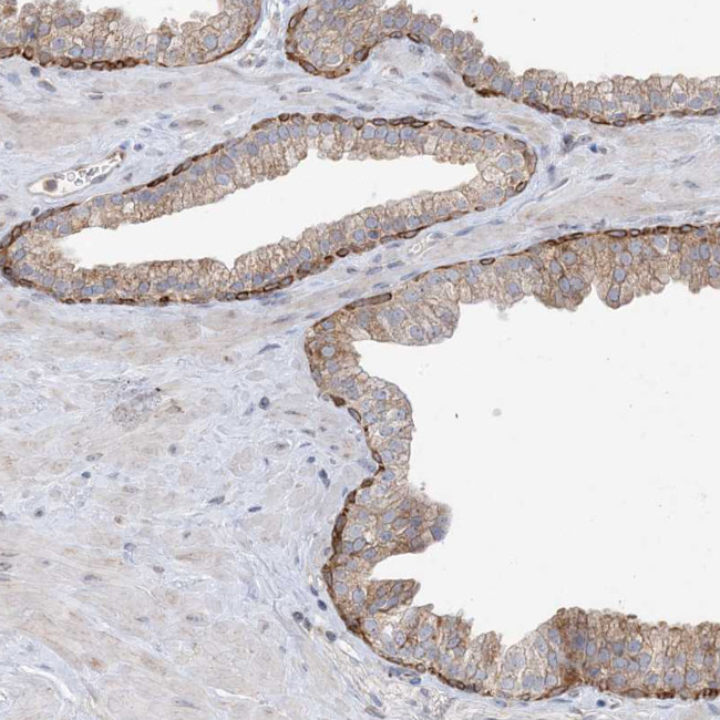 CNP Antibody in Immunohistochemistry (IHC)