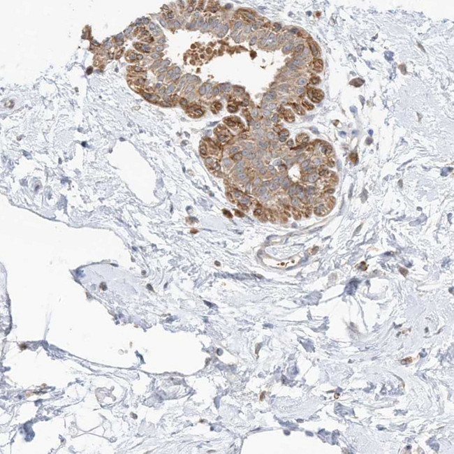 CNP Antibody in Immunohistochemistry (IHC)