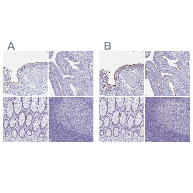 CCDC39 Antibody in Immunohistochemistry (IHC)