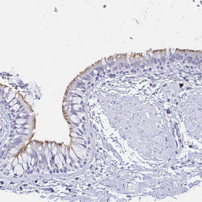 CCDC39 Antibody in Immunohistochemistry (IHC)