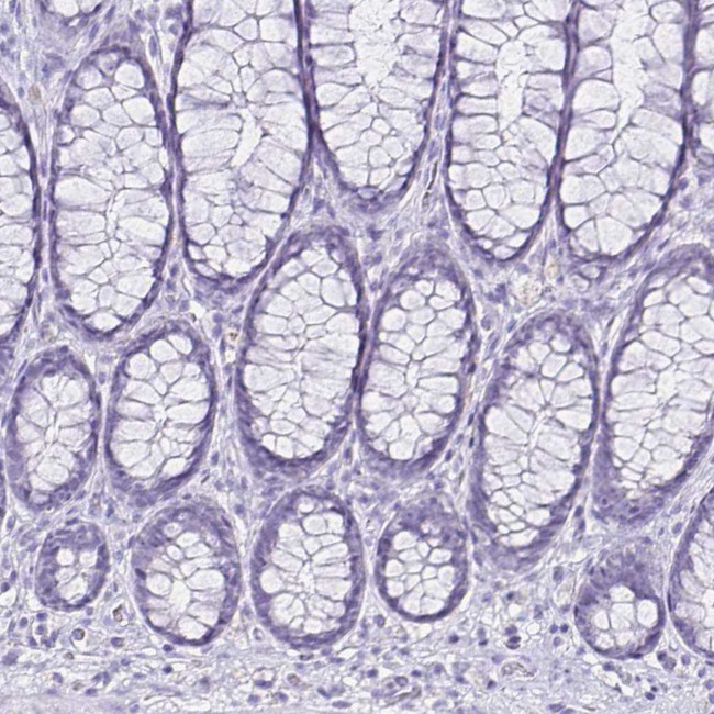 CCDC39 Antibody in Immunohistochemistry (IHC)