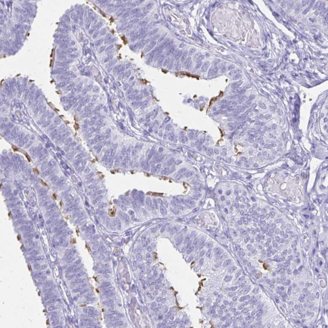 CCDC39 Antibody in Immunohistochemistry (IHC)