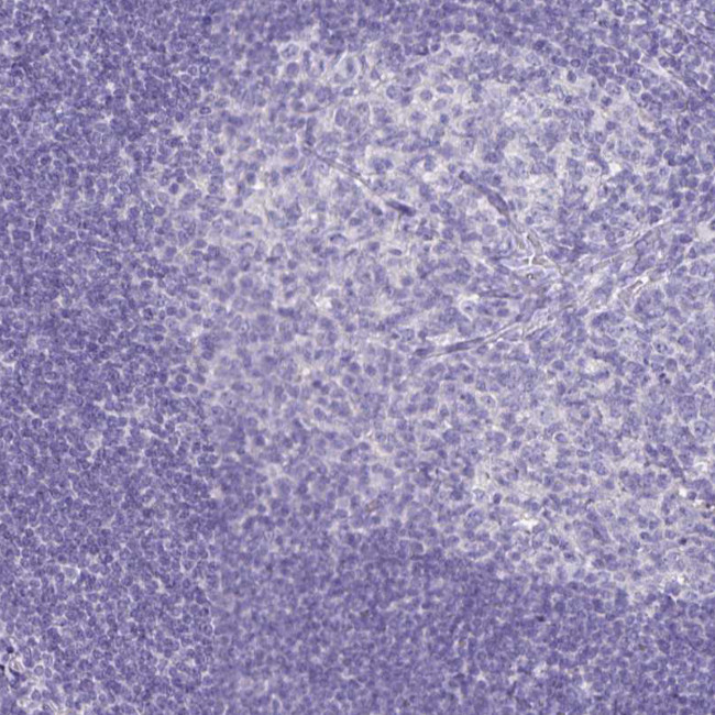 CCDC39 Antibody in Immunohistochemistry (IHC)