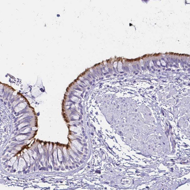 CCDC39 Antibody in Immunohistochemistry (IHC)