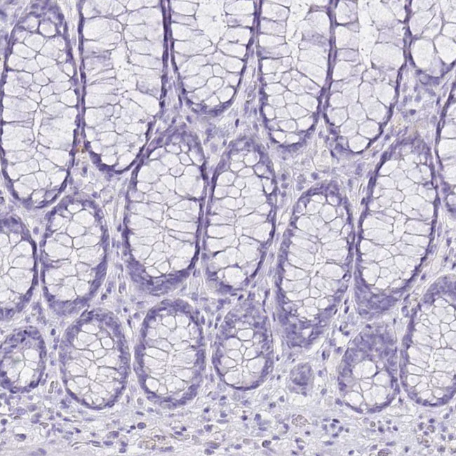 CCDC39 Antibody in Immunohistochemistry (IHC)