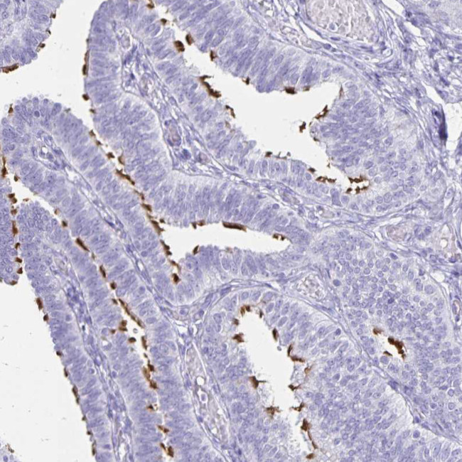 CCDC39 Antibody in Immunohistochemistry (IHC)