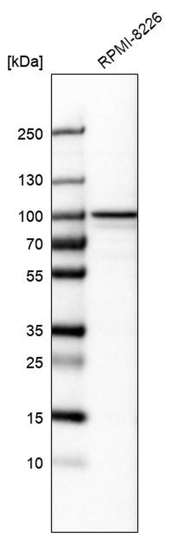 CCDC39 Antibody in Western Blot (WB)