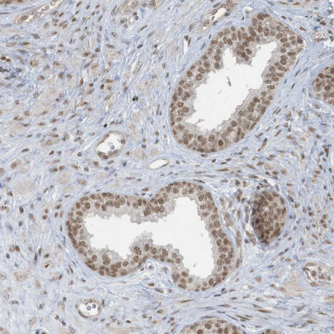 DBR1 Antibody in Immunohistochemistry (IHC)