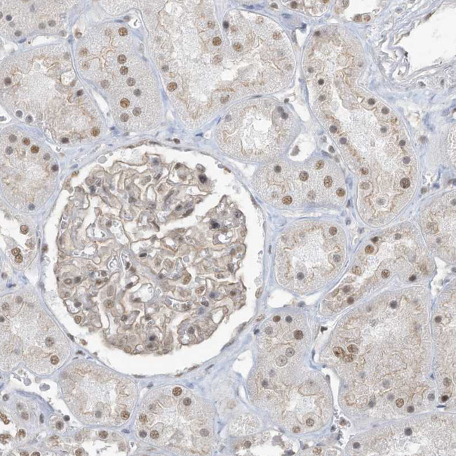 DBR1 Antibody in Immunohistochemistry (IHC)