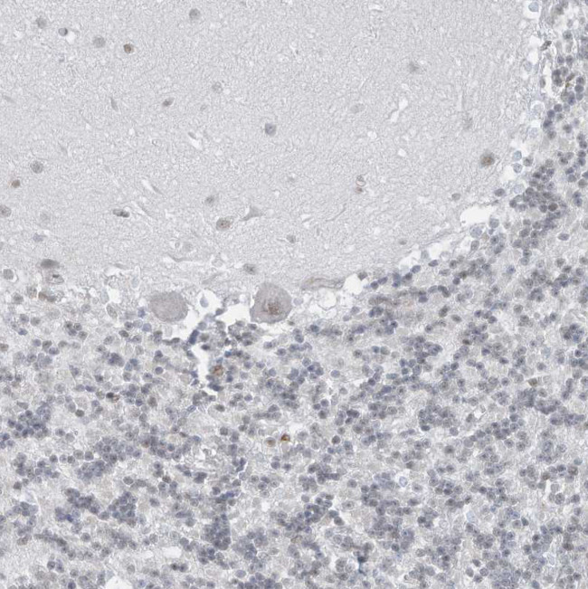 DBR1 Antibody in Immunohistochemistry (IHC)