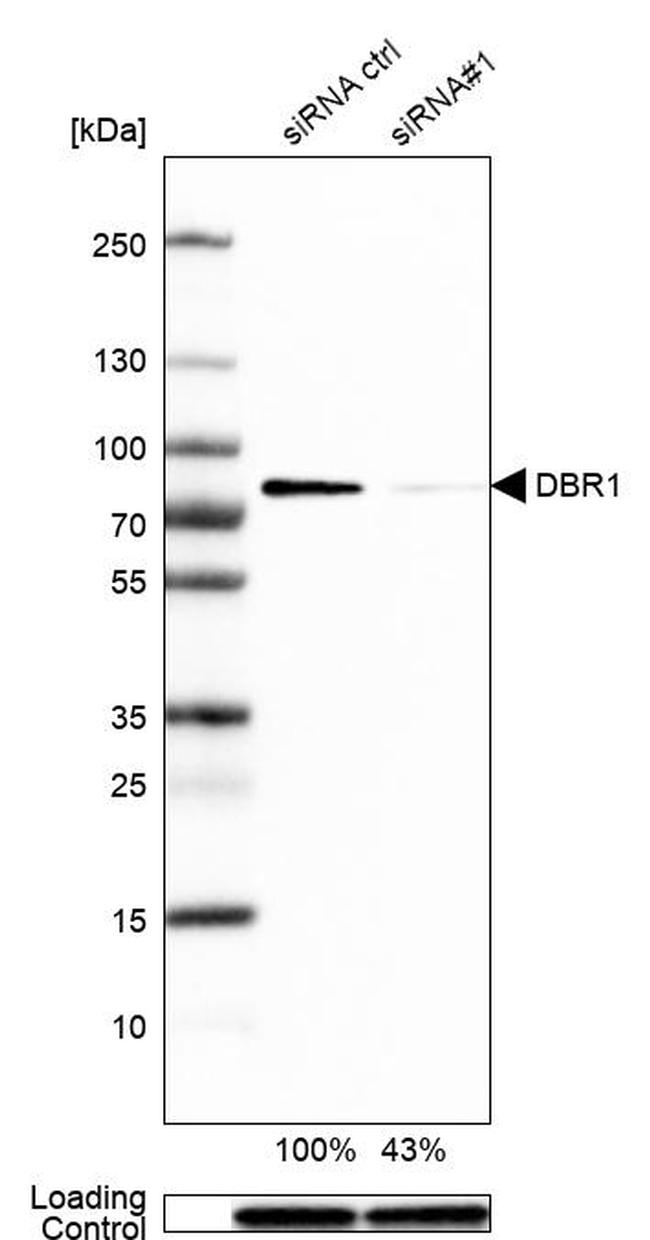 DBR1 Antibody in Western Blot (WB)