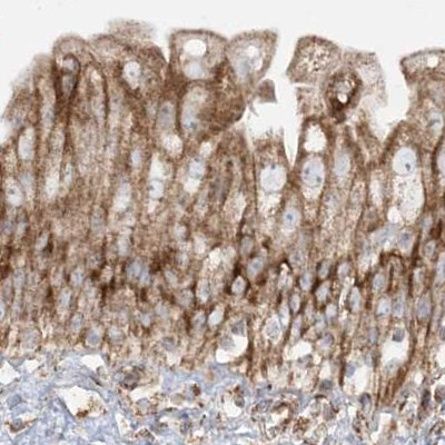 NDUFAF3 Antibody in Immunohistochemistry (IHC)