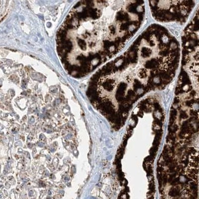 NDUFAF3 Antibody in Immunohistochemistry (IHC)