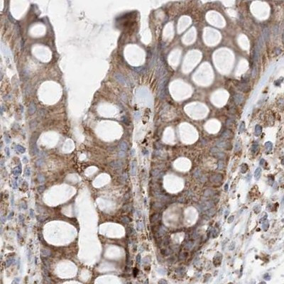 NDUFAF3 Antibody in Immunohistochemistry (IHC)