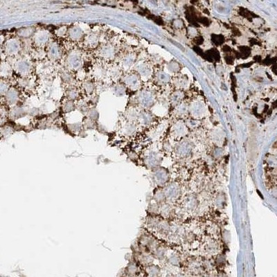 NDUFAF3 Antibody in Immunohistochemistry (IHC)