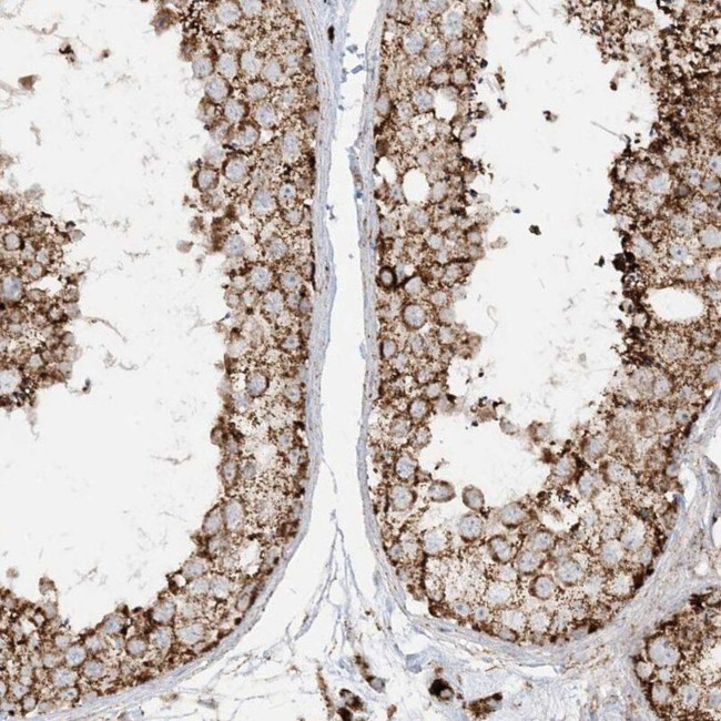 NDUFAF3 Antibody in Immunohistochemistry (IHC)