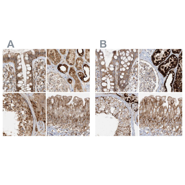 NDUFAF3 Antibody in Immunohistochemistry (IHC)