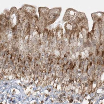 NDUFAF3 Antibody in Immunohistochemistry (IHC)