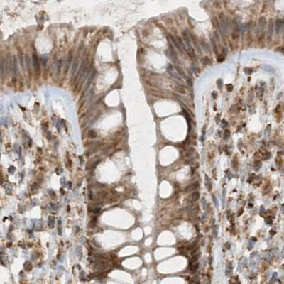 NDUFAF3 Antibody in Immunohistochemistry (IHC)