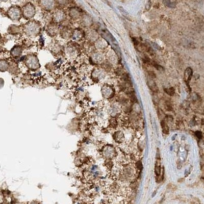 NDUFAF3 Antibody in Immunohistochemistry (IHC)