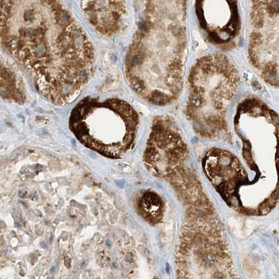 NDUFAF3 Antibody in Immunohistochemistry (IHC)