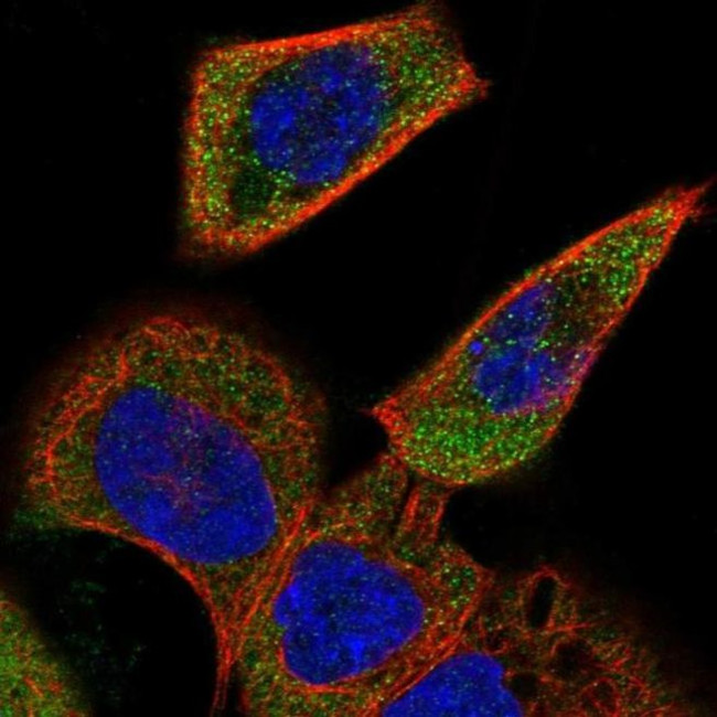 ACOXL Antibody in Immunocytochemistry (ICC/IF)