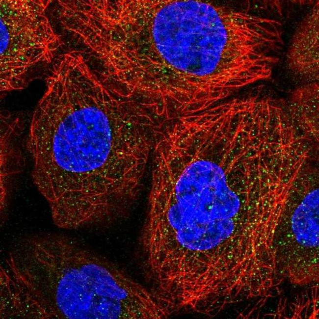 ACOXL Antibody in Immunocytochemistry (ICC/IF)