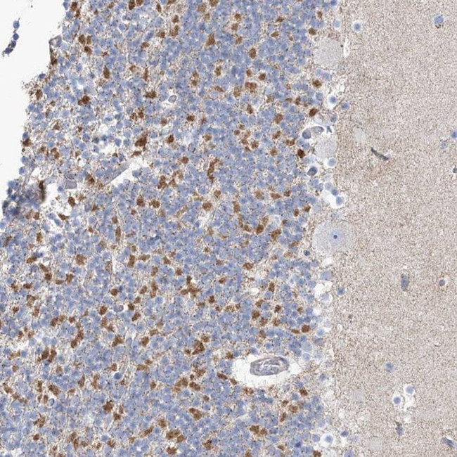 MTHFD2L Antibody in Immunohistochemistry (IHC)