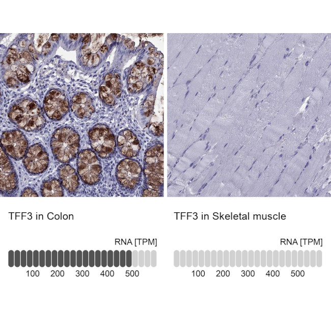 TFF3 Antibody in Immunohistochemistry (IHC)