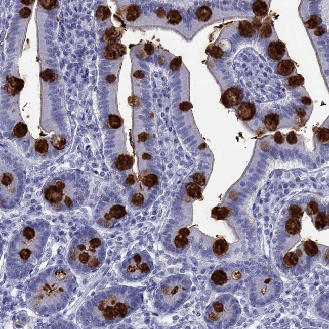 TFF3 Antibody in Immunohistochemistry (IHC)