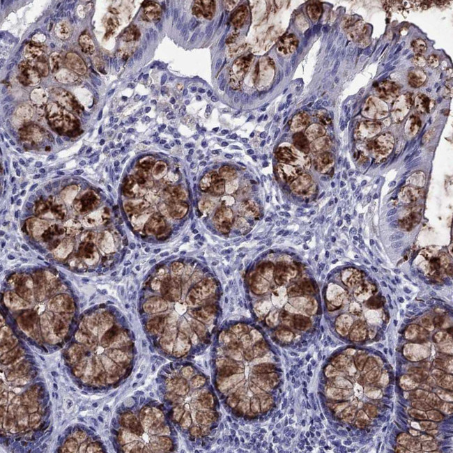 TFF3 Antibody in Immunohistochemistry (IHC)