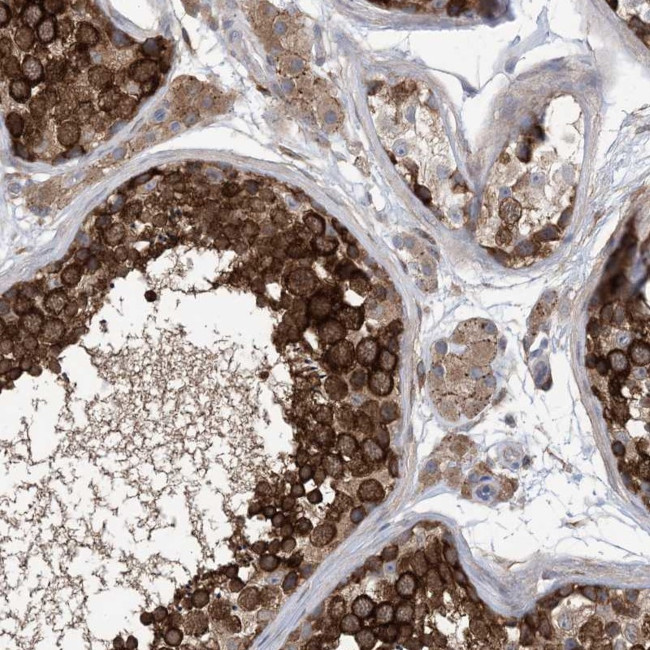 EHBP1 Antibody in Immunohistochemistry (IHC)