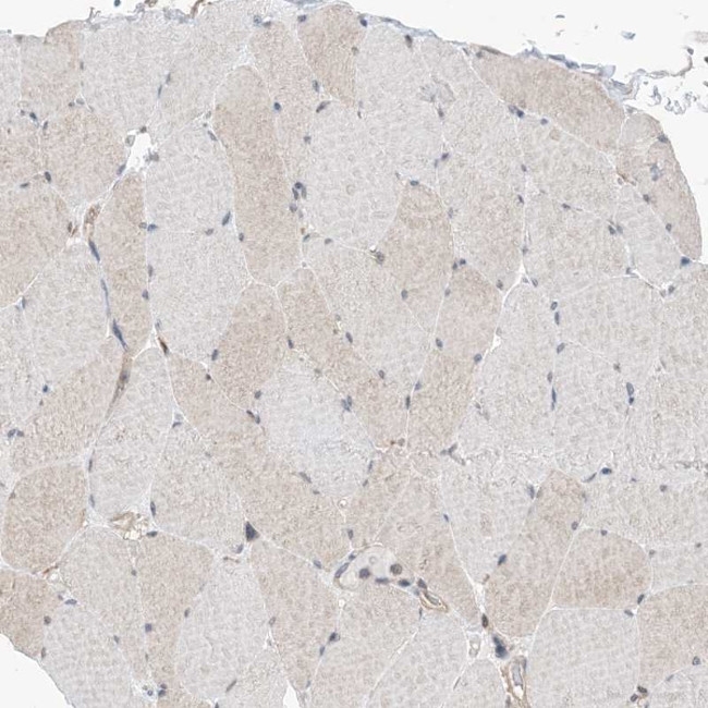 EHBP1 Antibody in Immunohistochemistry (IHC)