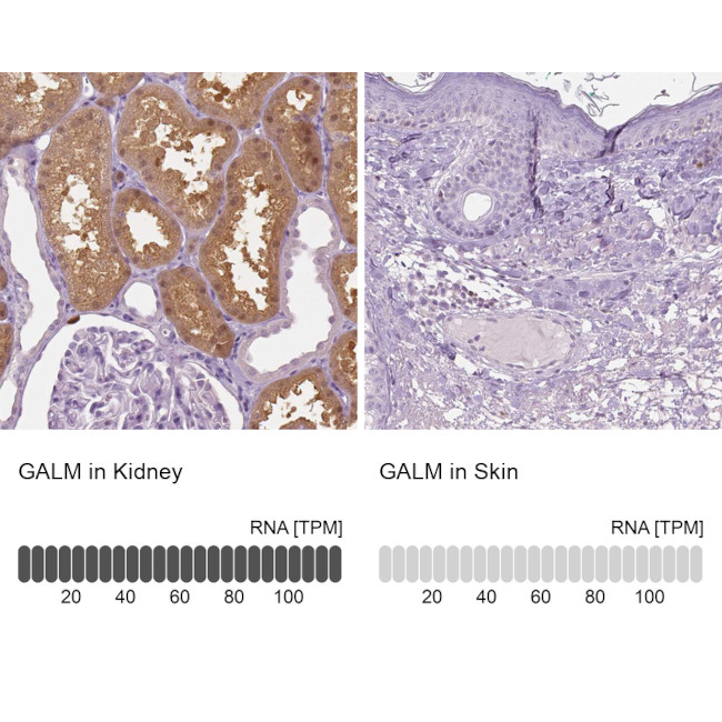 GALM Antibody in Immunohistochemistry (IHC)