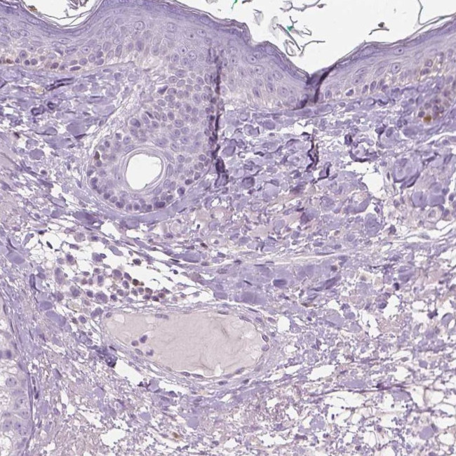 GALM Antibody in Immunohistochemistry (IHC)