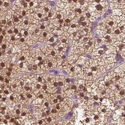 GALM Antibody in Immunohistochemistry (IHC)