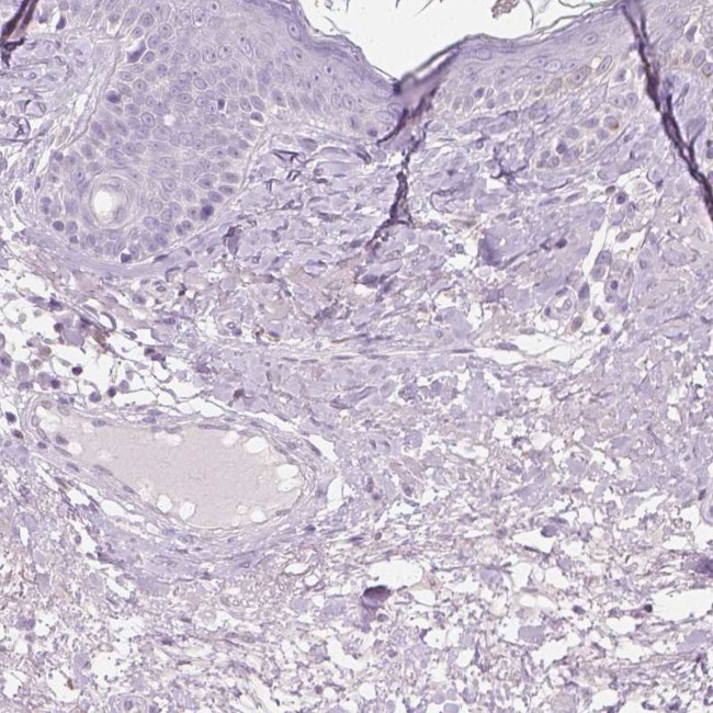 GALM Antibody in Immunohistochemistry (IHC)