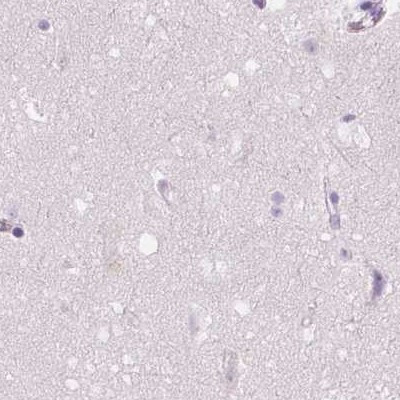 GALM Antibody in Immunohistochemistry (IHC)