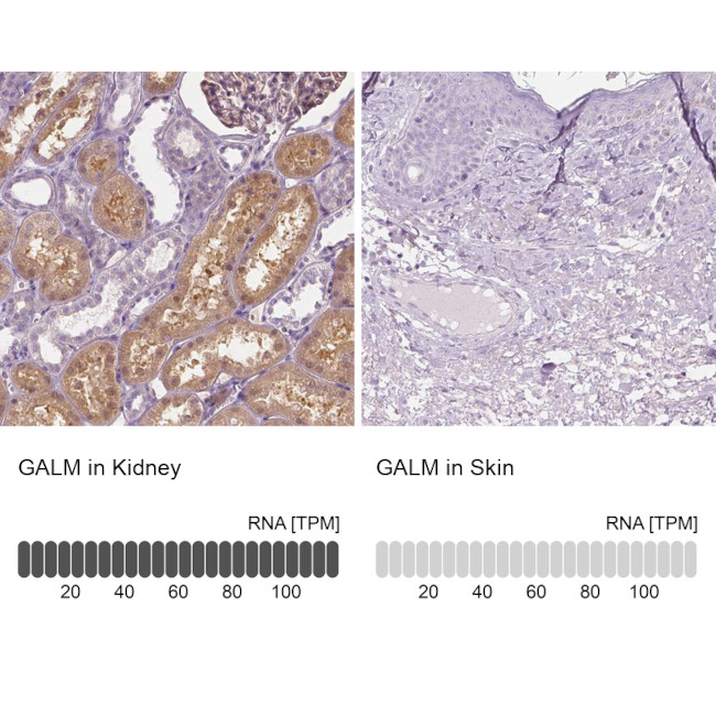 GALM Antibody