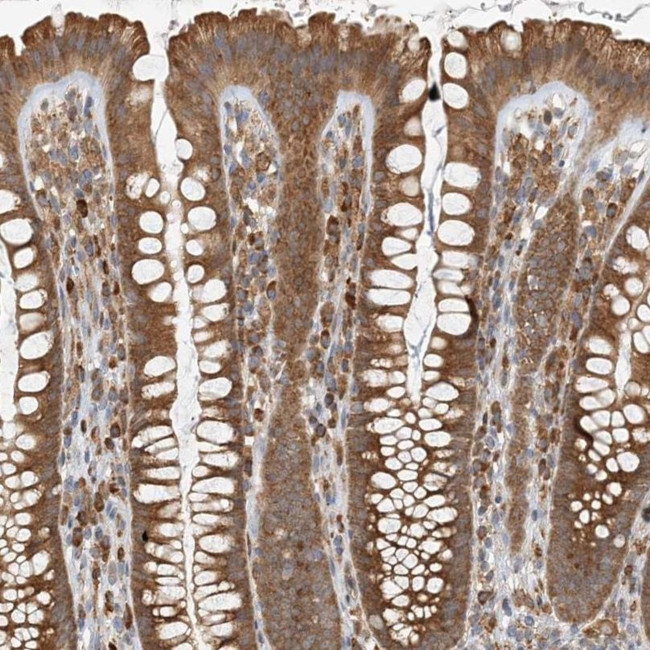 HNMT Antibody in Immunohistochemistry (IHC)