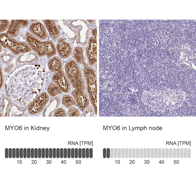 MYO6 Antibody in Immunohistochemistry (IHC)