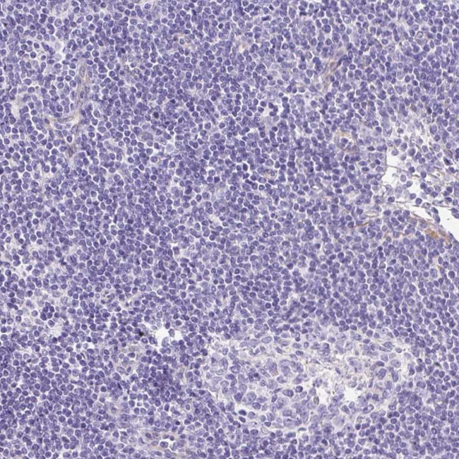 MYO6 Antibody in Immunohistochemistry (IHC)