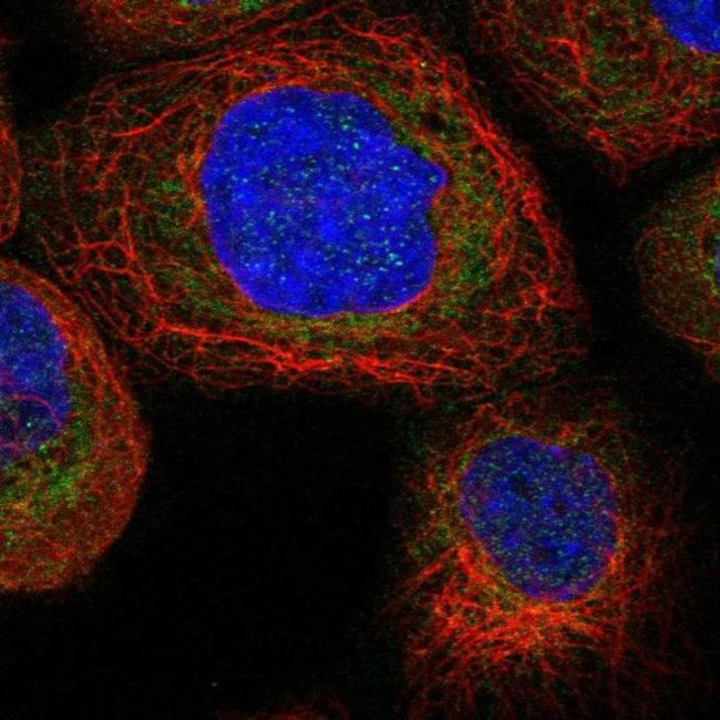 TTC21B Antibody in Immunocytochemistry (ICC/IF)