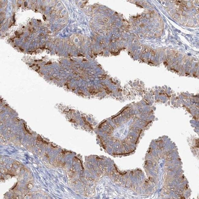 TTC21B Antibody in Immunohistochemistry (IHC)