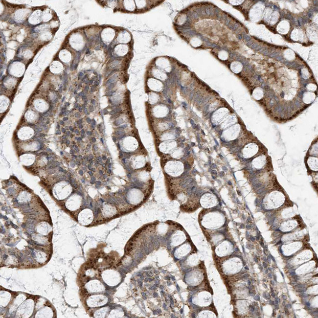 KIF15 Antibody in Immunohistochemistry (IHC)