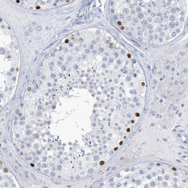 SLC35A5 Antibody in Immunohistochemistry (IHC)